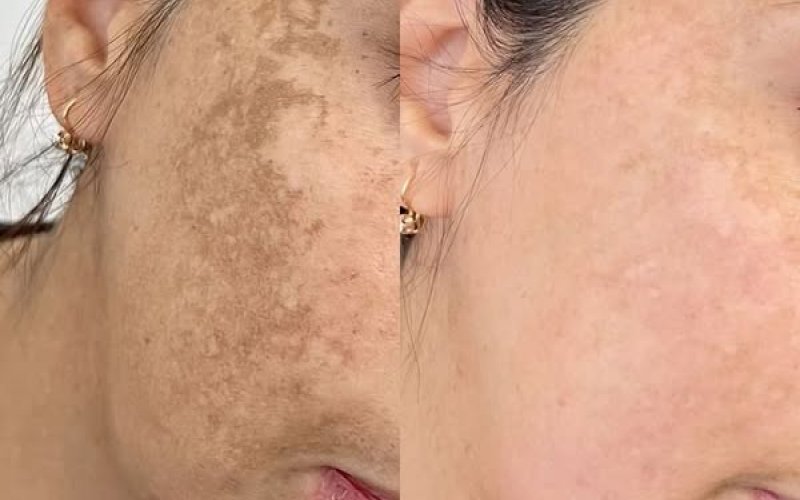 Cilt Sorunları İçin Profesyonel Çözümler